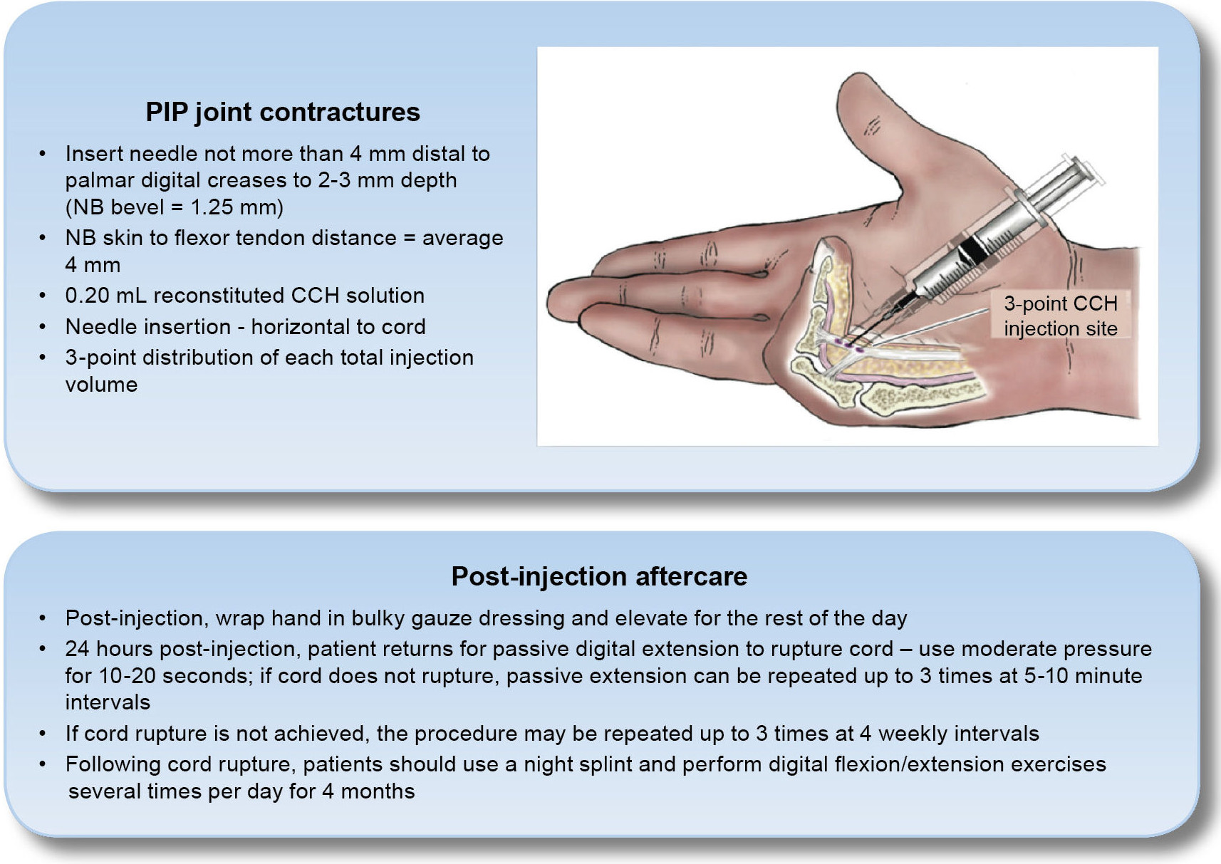 Figure 15: CCH injection technique for MP and PIP joints and suggested aftercare