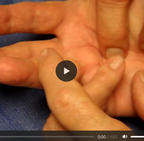 This shows injection technique beginning with the ring finger 